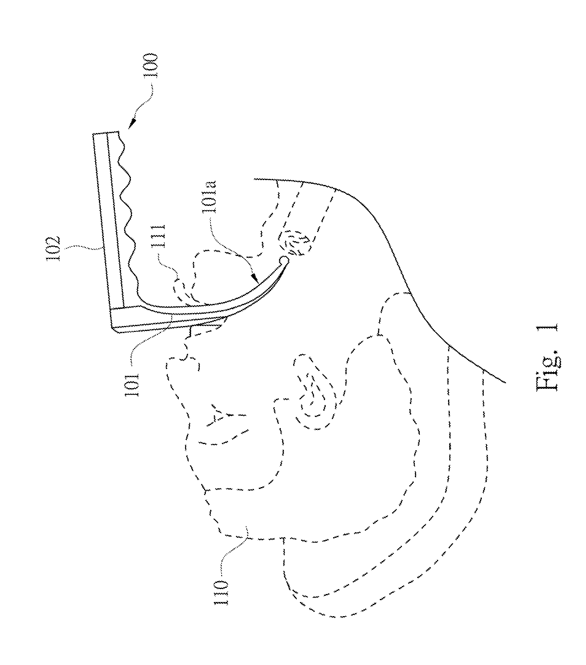 Laryngoscope Handle