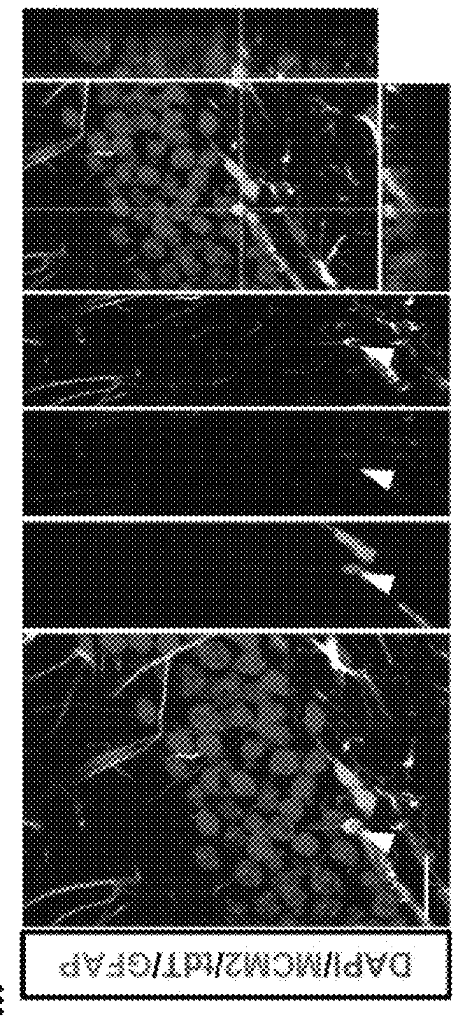 Methods for treating cognitive deficits associated with fragile X syndrome