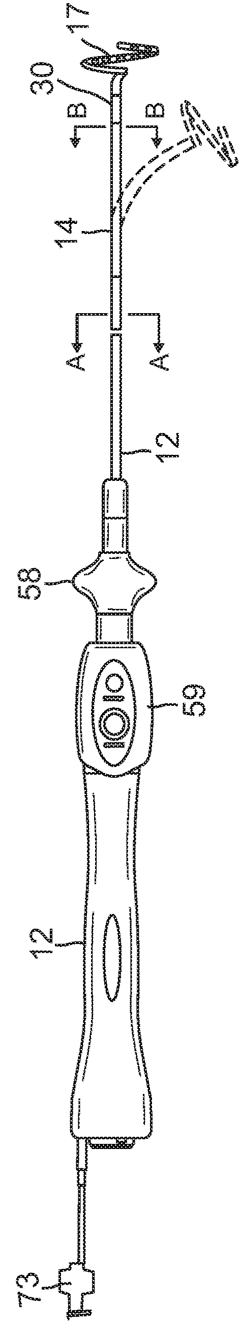 Catheter with improved loop contraction and greater contraction displacement