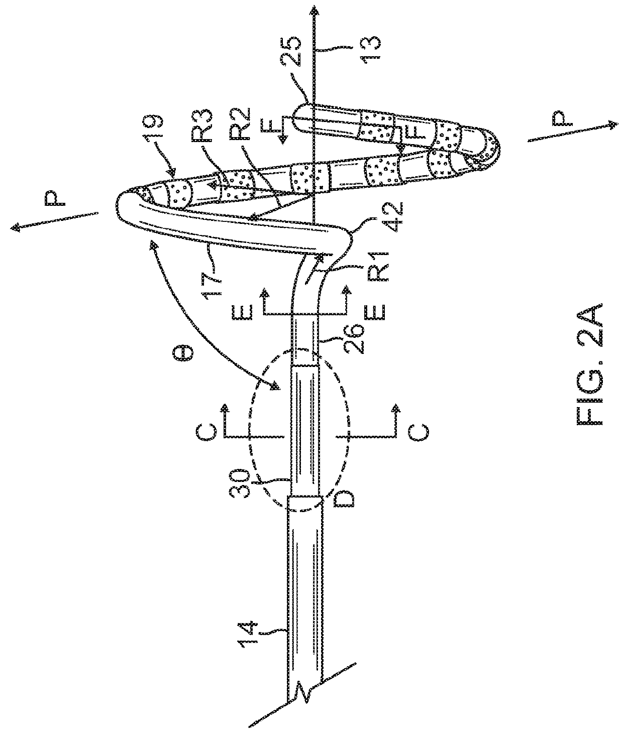 Catheter with improved loop contraction and greater contraction displacement