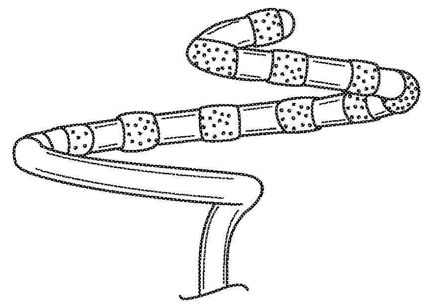 Catheter with improved loop contraction and greater contraction displacement