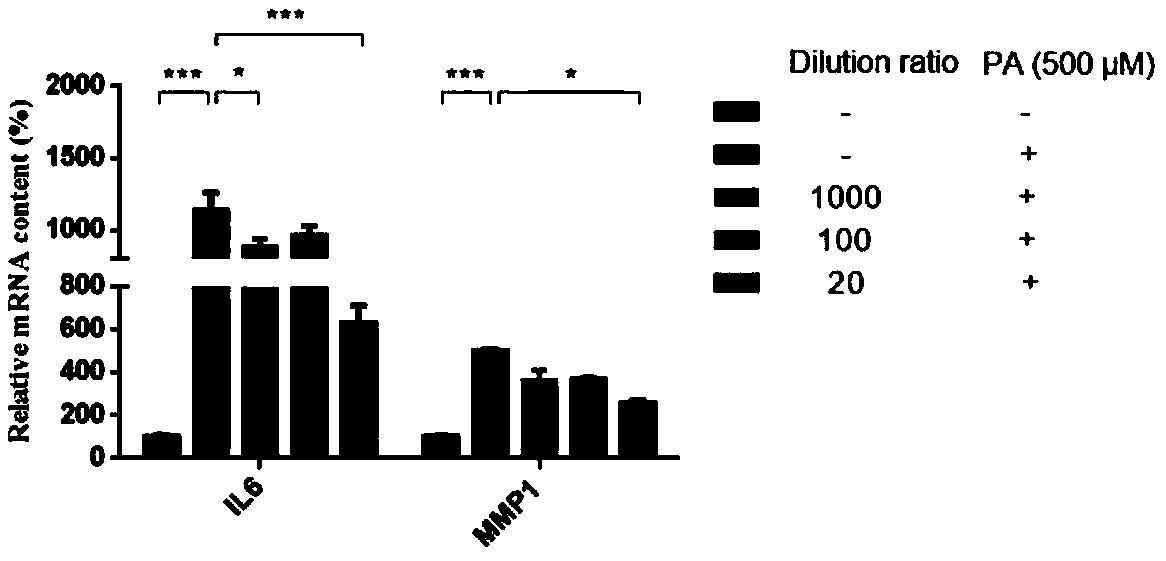 Drug for improving function of aortic endothelial cells and application thereof