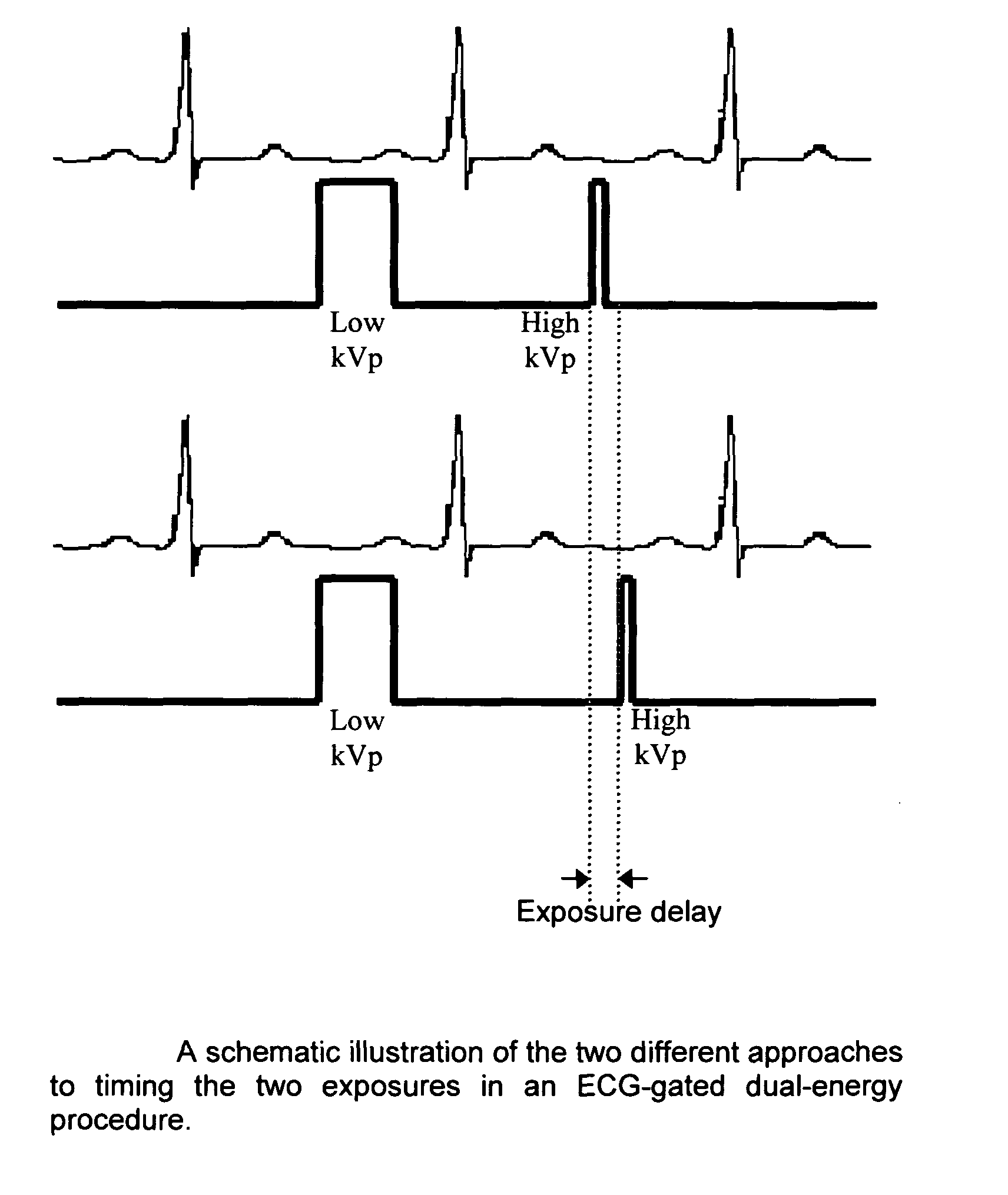 Methods and apparatus for gated acquisitions in digital radiography