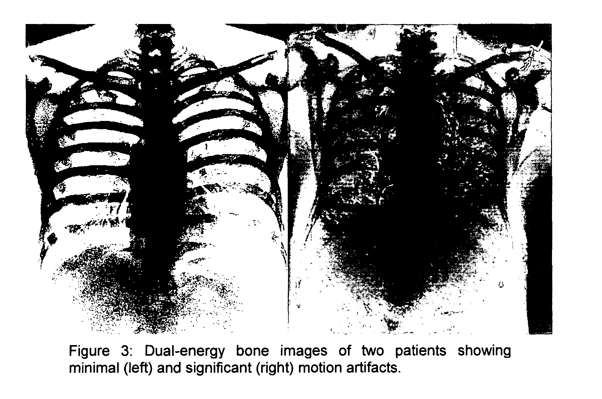 Methods and apparatus for gated acquisitions in digital radiography