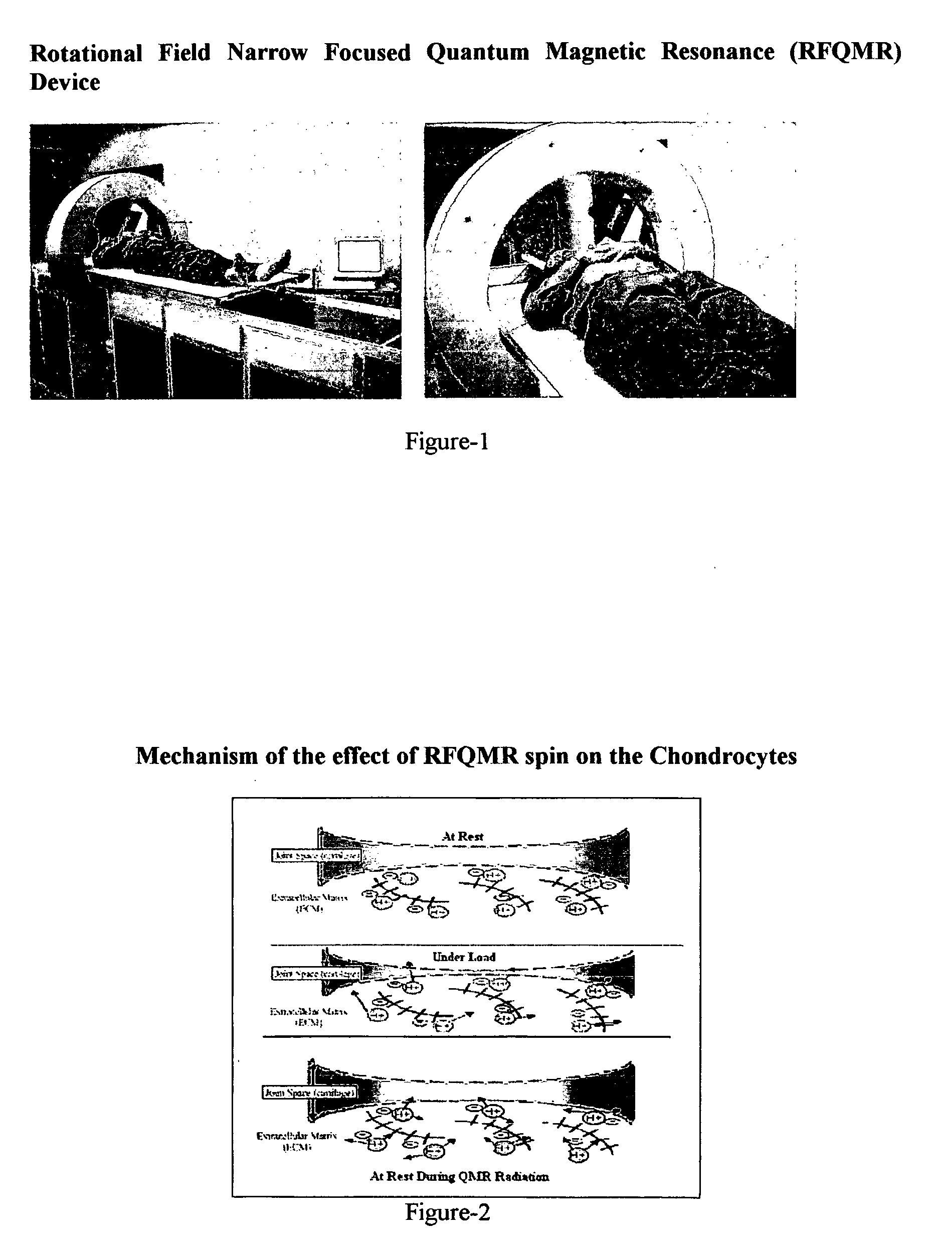 Method for tissue regeneration or degeneration in human and an apparatus therefore