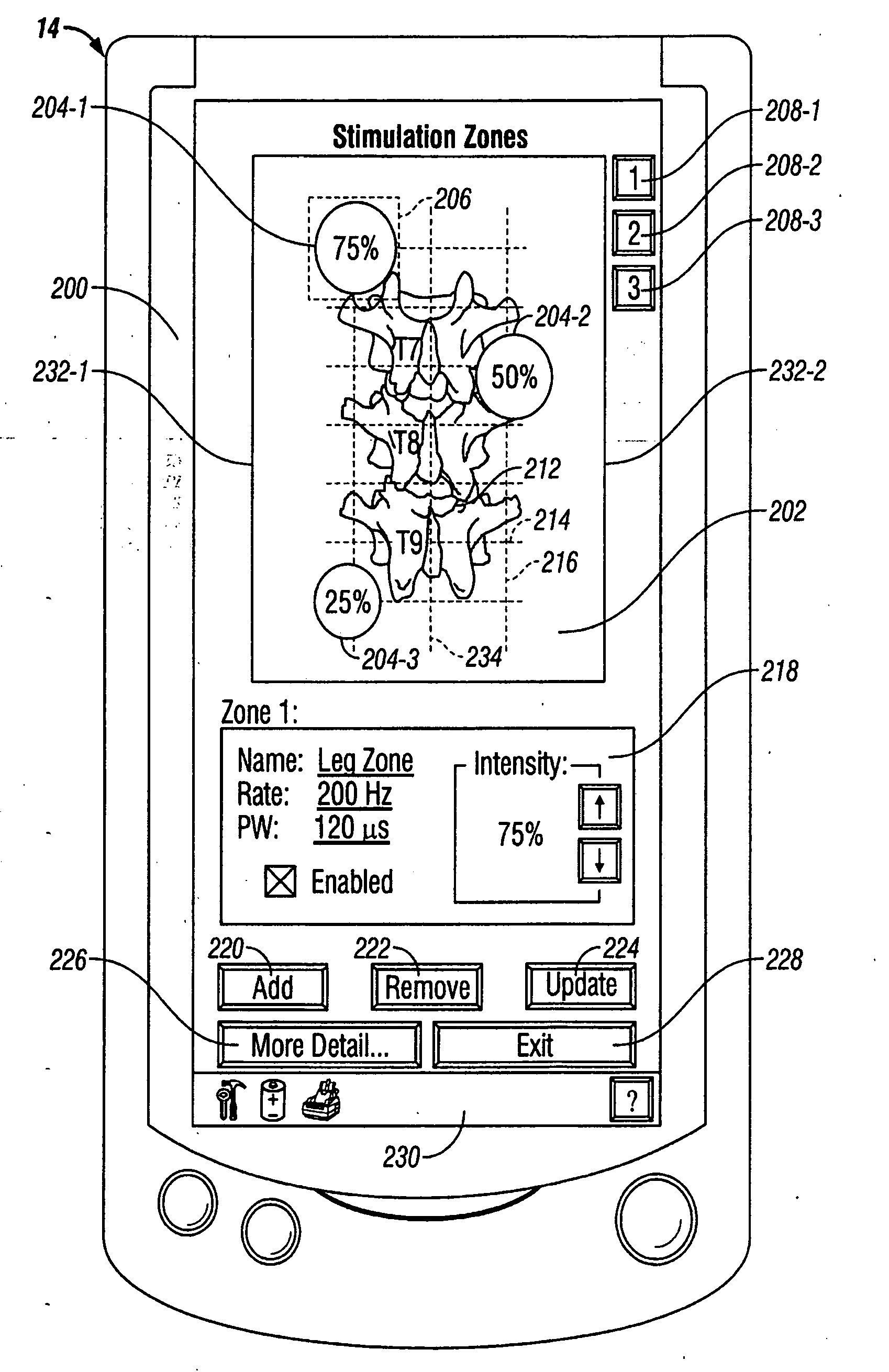 Human-implantable-neurostimulator user interface having multiple levels of abstraction