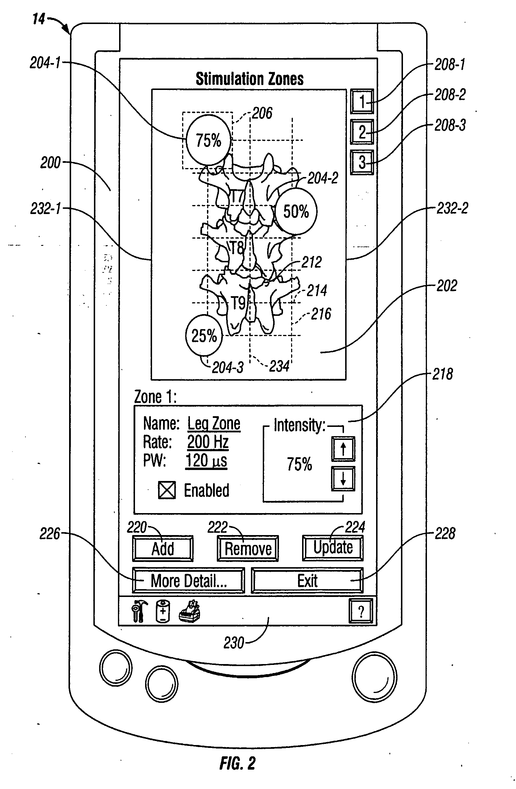 Human-implantable-neurostimulator user interface having multiple levels of abstraction