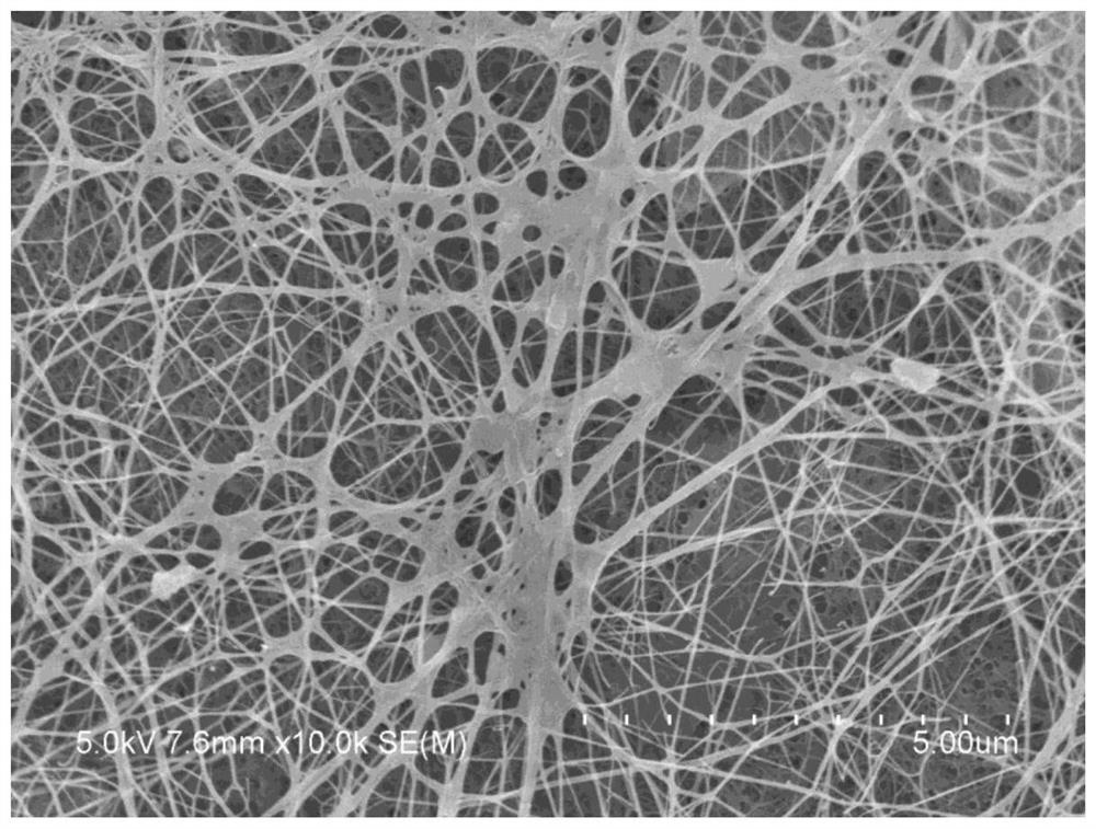 Antibacterial elastic composite medical dressing and preparation method thereof