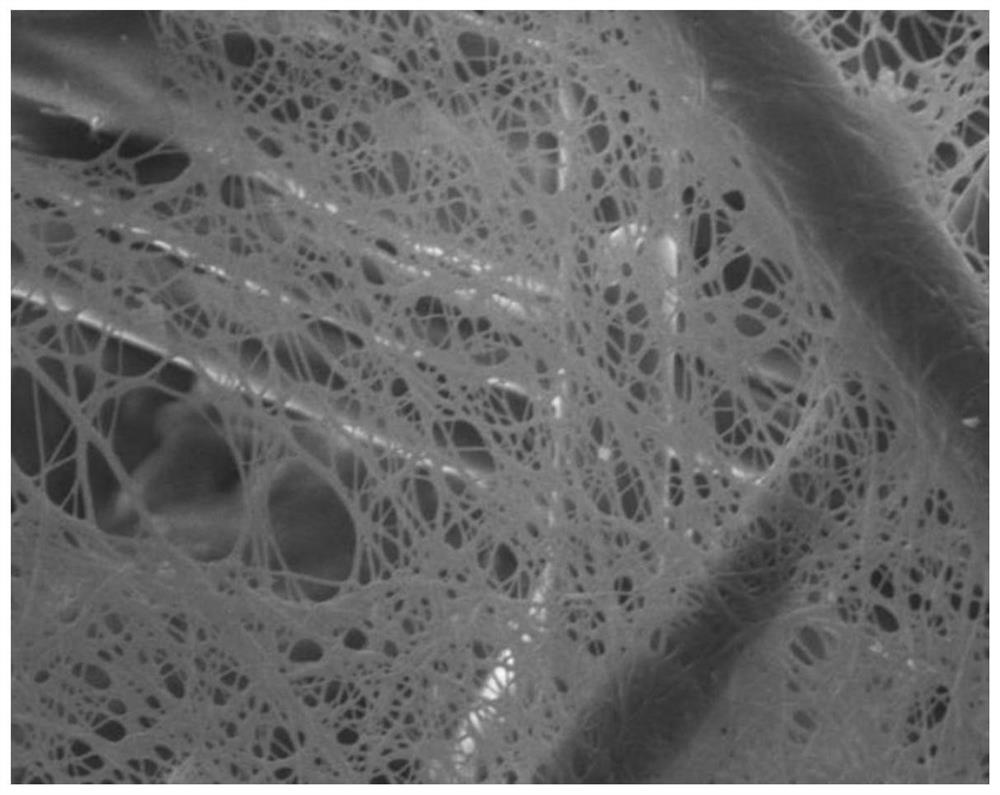 Antibacterial elastic composite medical dressing and preparation method thereof