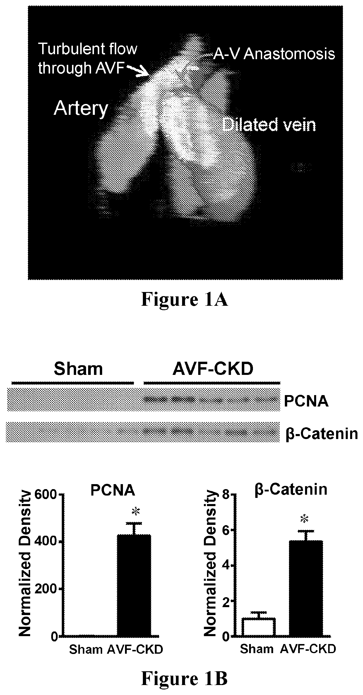 Methods and materials for improving arteriovenous fistula maturation and maintaining arteriovenous fistula functionality