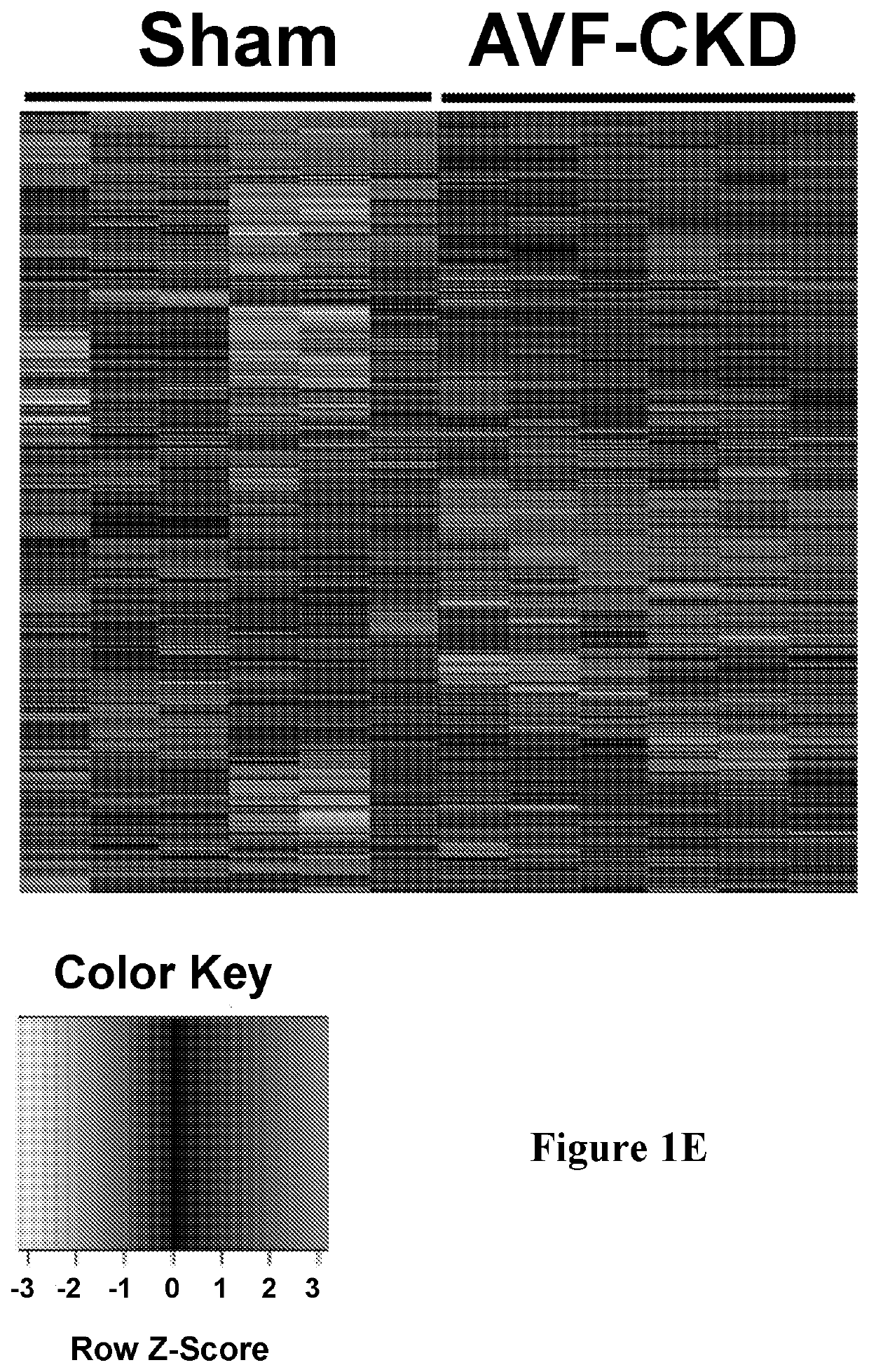 Methods and materials for improving arteriovenous fistula maturation and maintaining arteriovenous fistula functionality