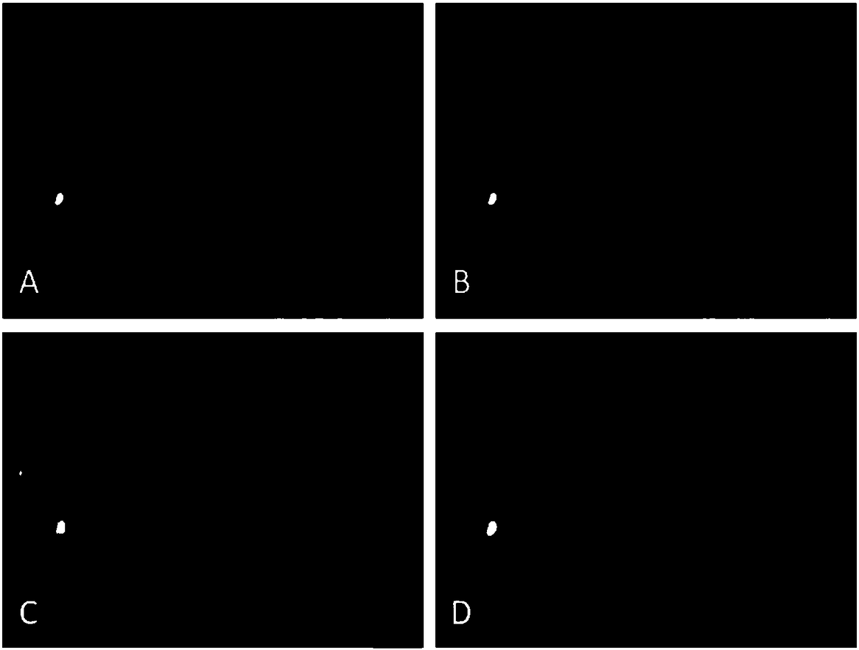 Method for improving development efficiency of porcine cloned embryo