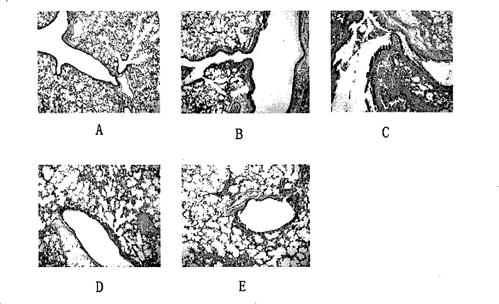 Clerodendrum bungei extract and use thereof for treating airway hyperreactivity