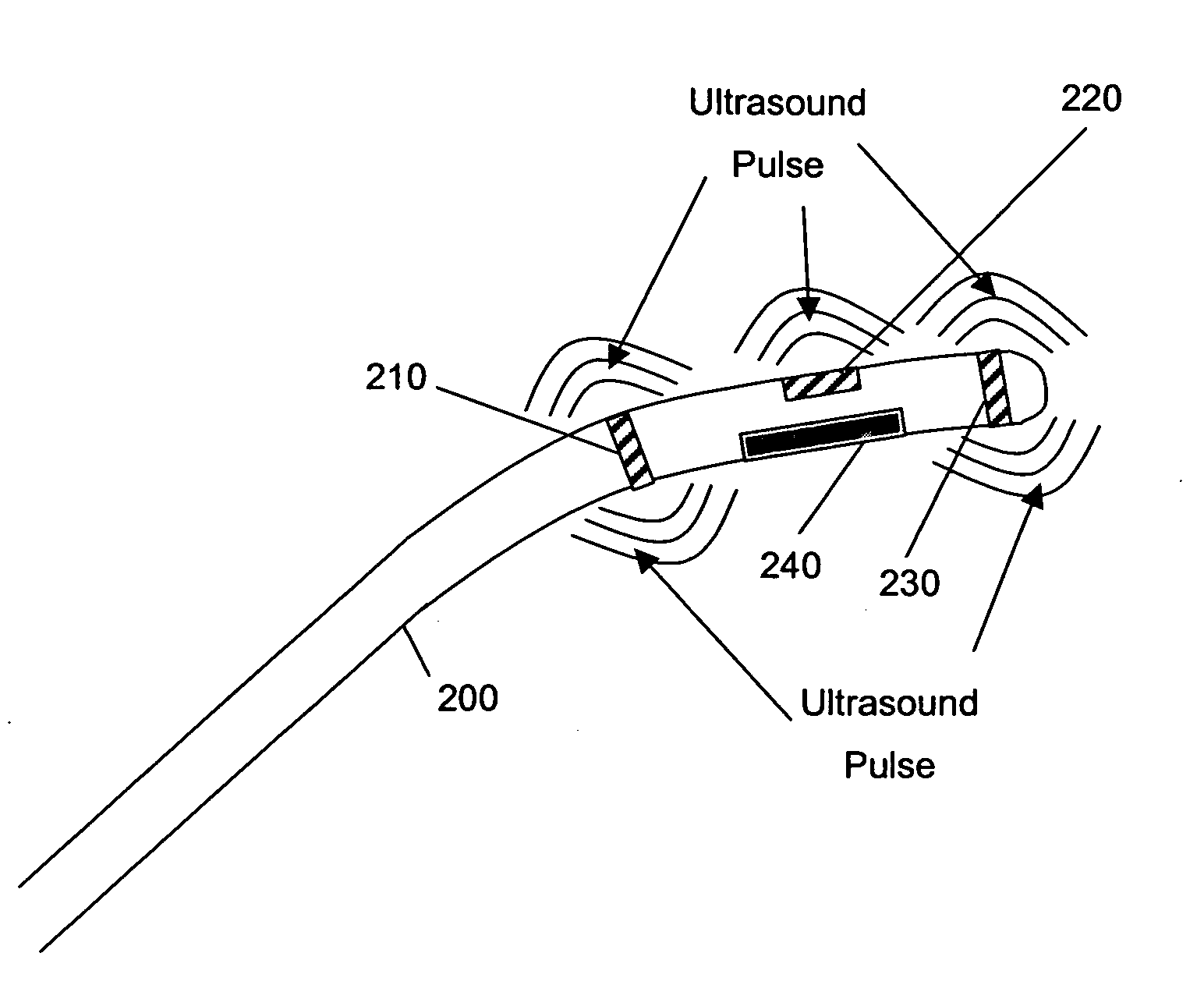 Method and apparatus for localizing an ultrasound catheter