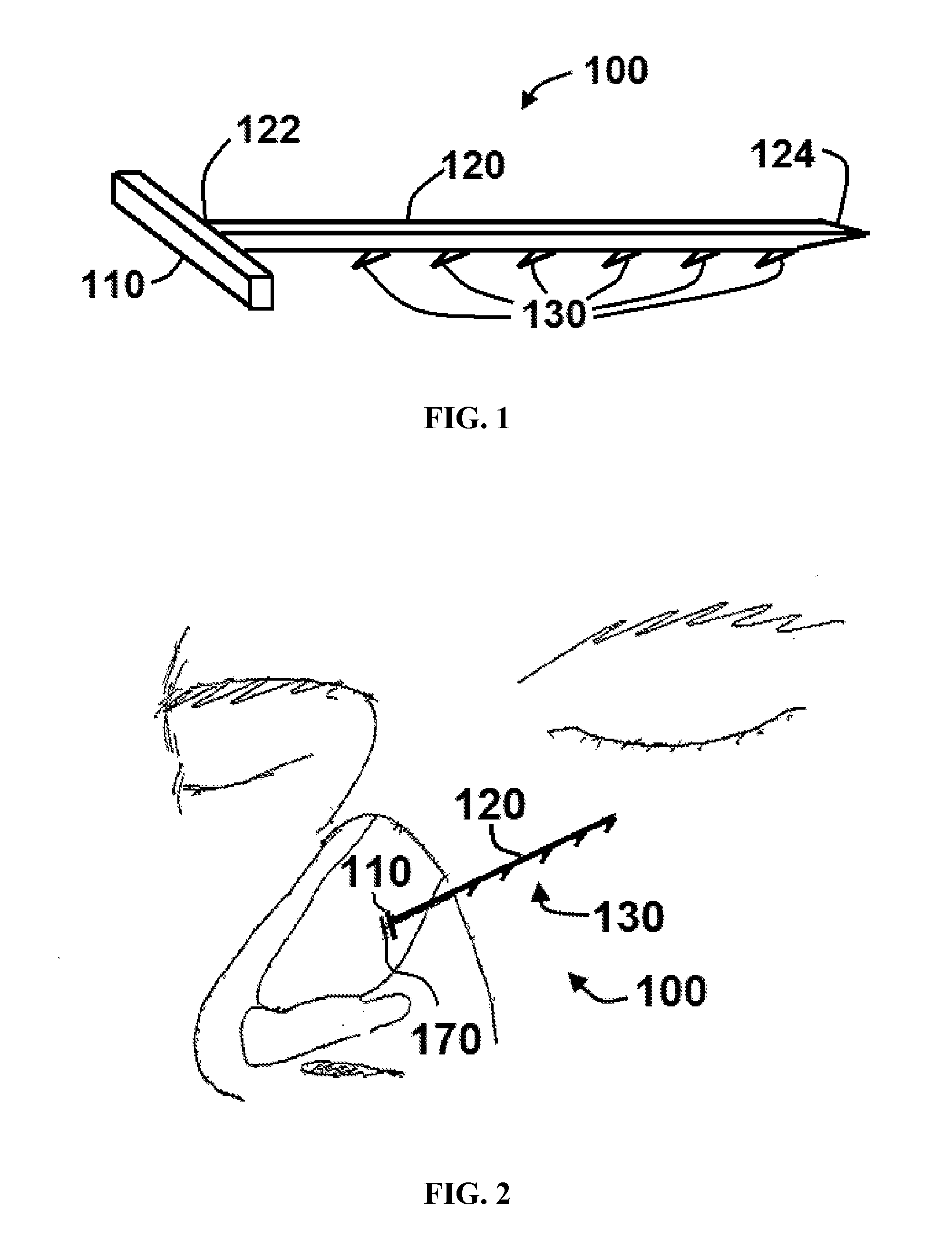 Apparatus and methods for correcting nasal valve collapse