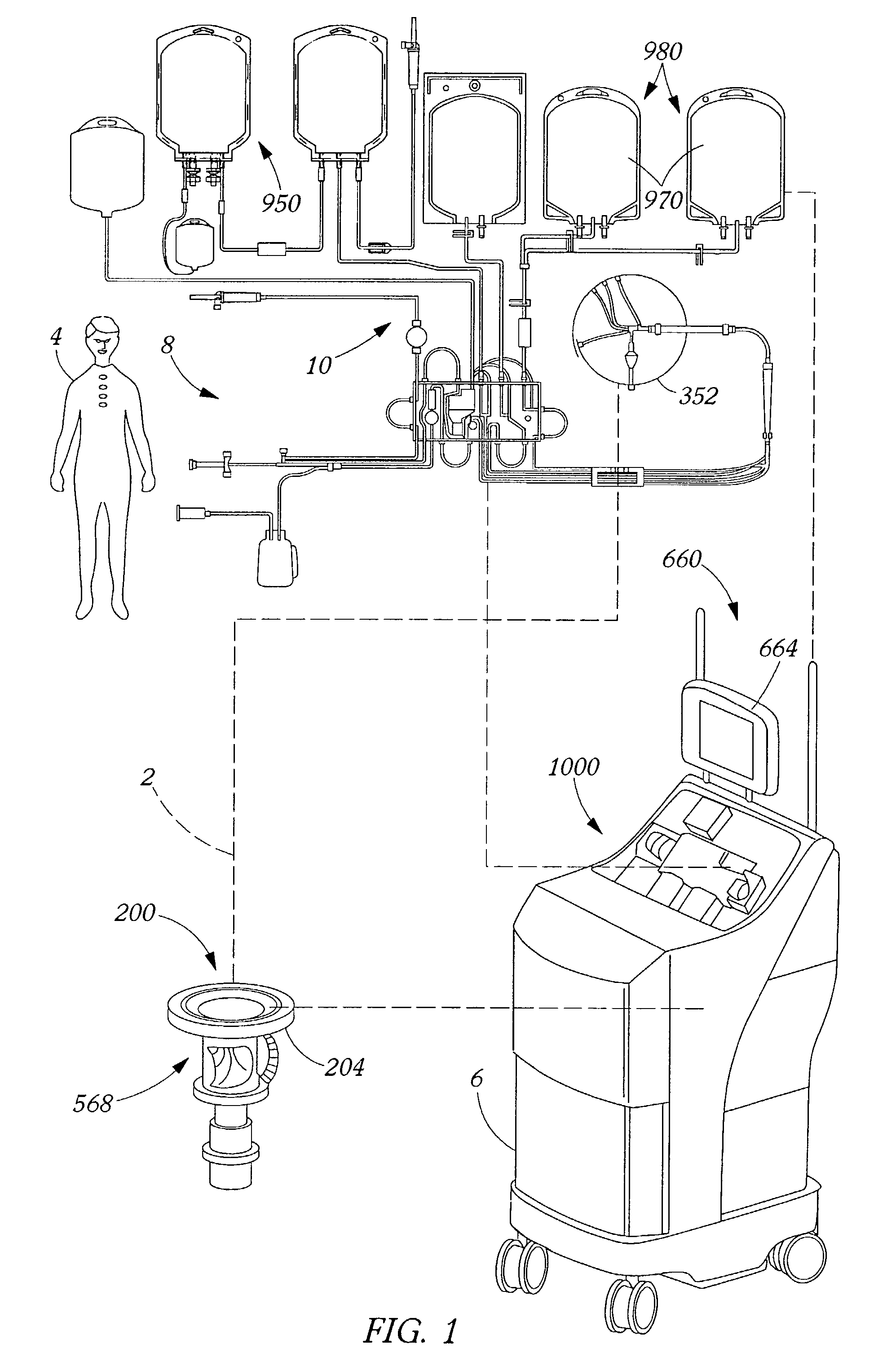 Methods and apparatus for leukoreduction of red blood cells