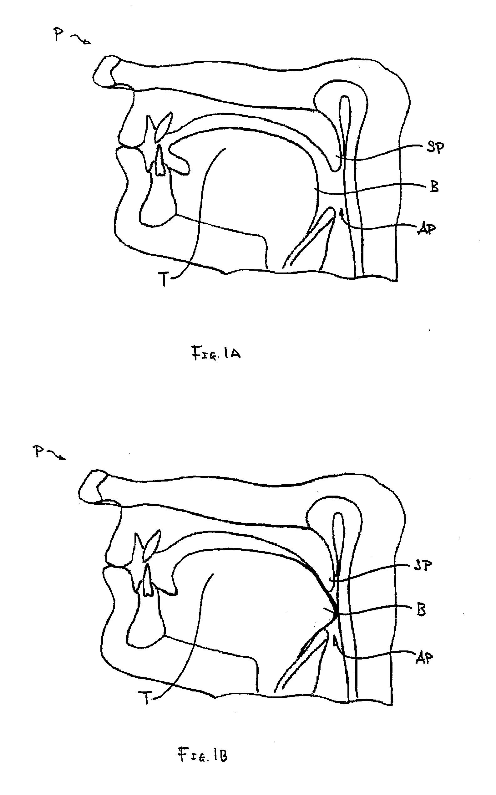 Tongue retention system