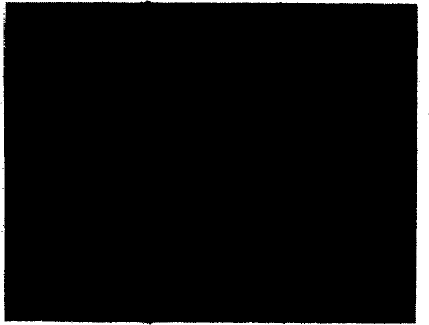 Process for preparing composite coat of hydroxy apatite and aluminum oxide