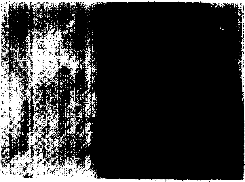 Process for preparing composite coat of hydroxy apatite and aluminum oxide