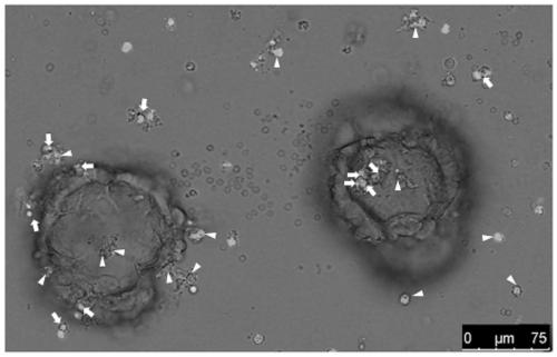 Method for culturing bladder cancer organs in vitro