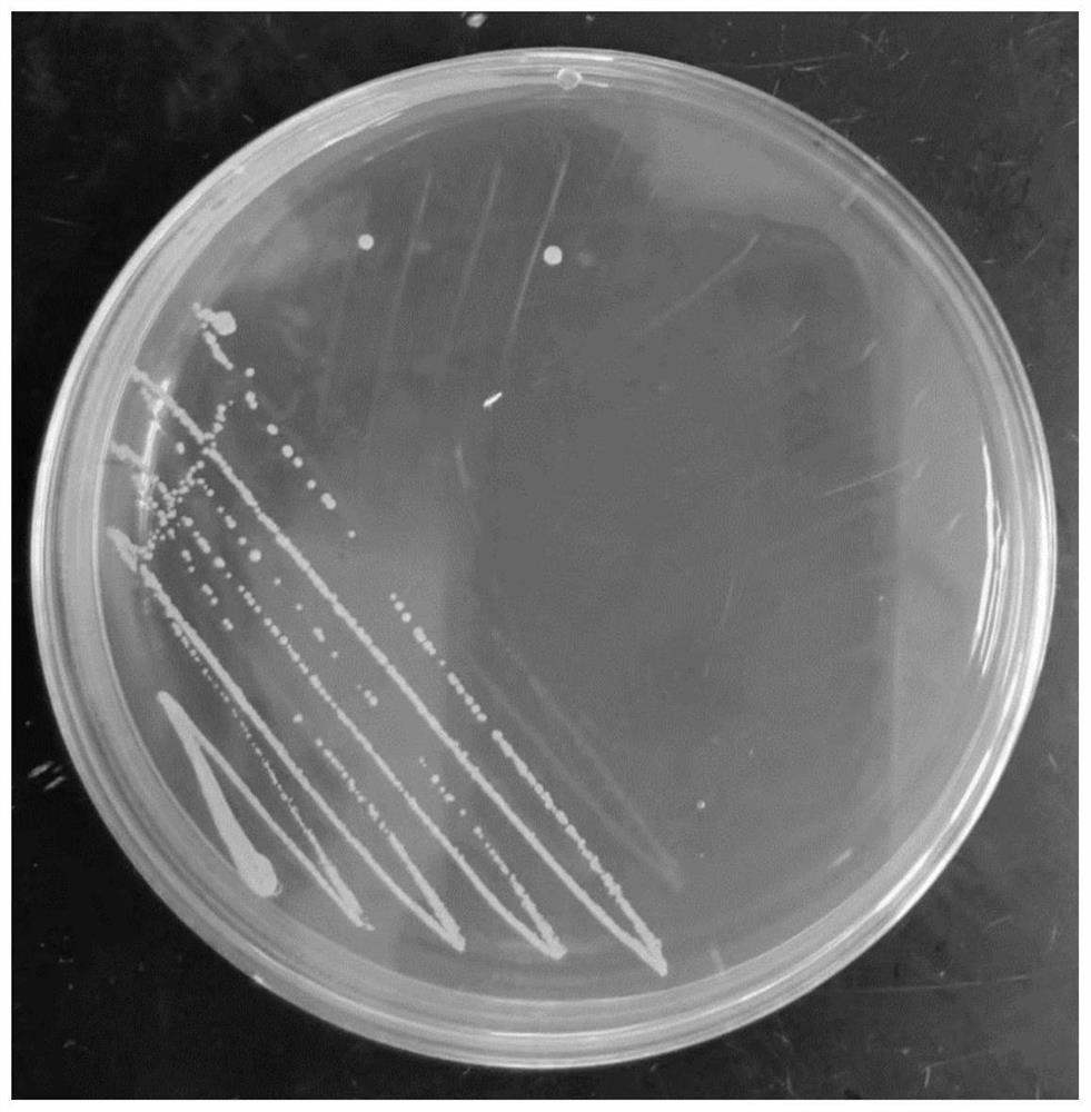 Lactobacillus paracasei capable of efficiently expressing adenosine deaminase to relieve colitis