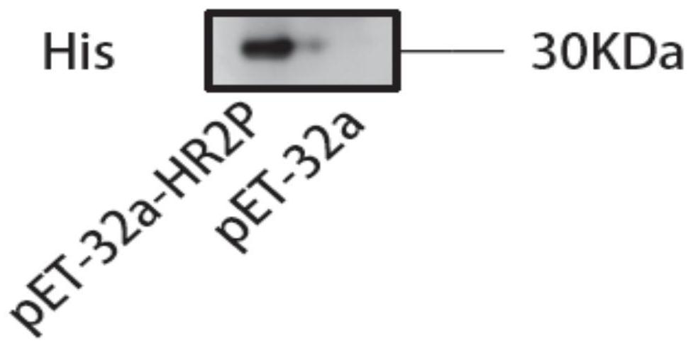 Recombinant bacillus subtilis and application thereof