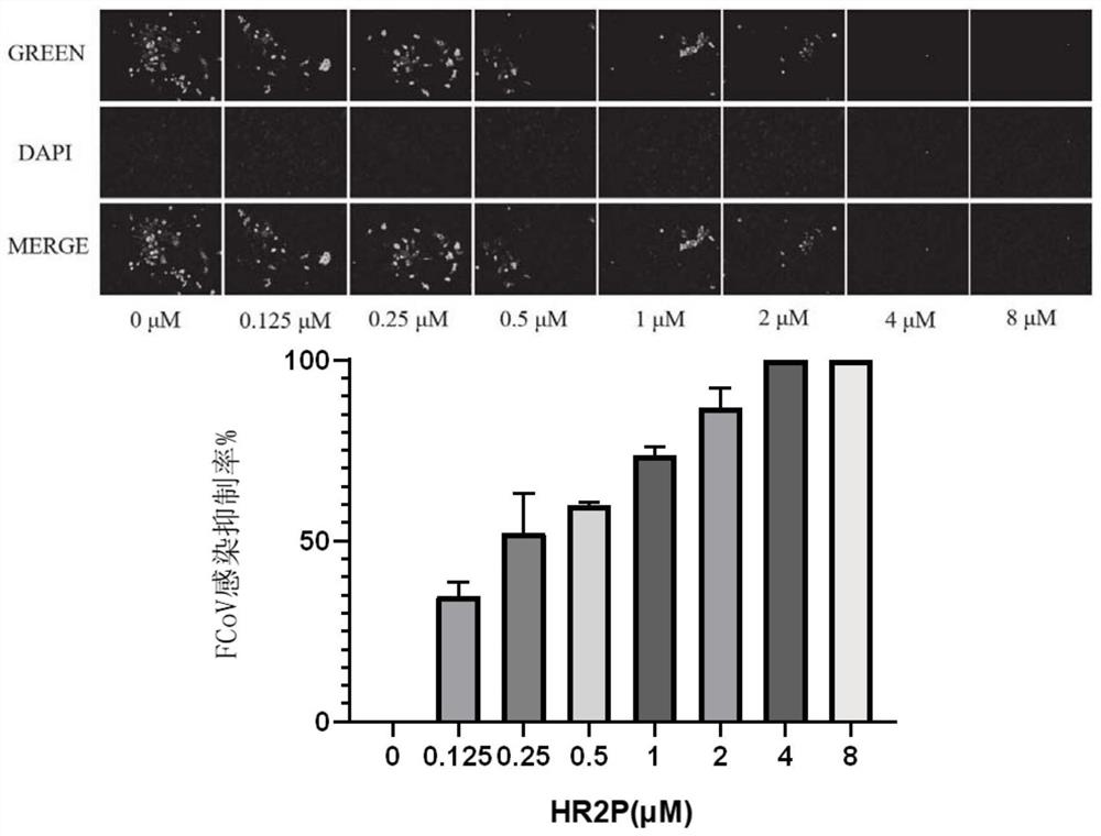 Recombinant bacillus subtilis and application thereof