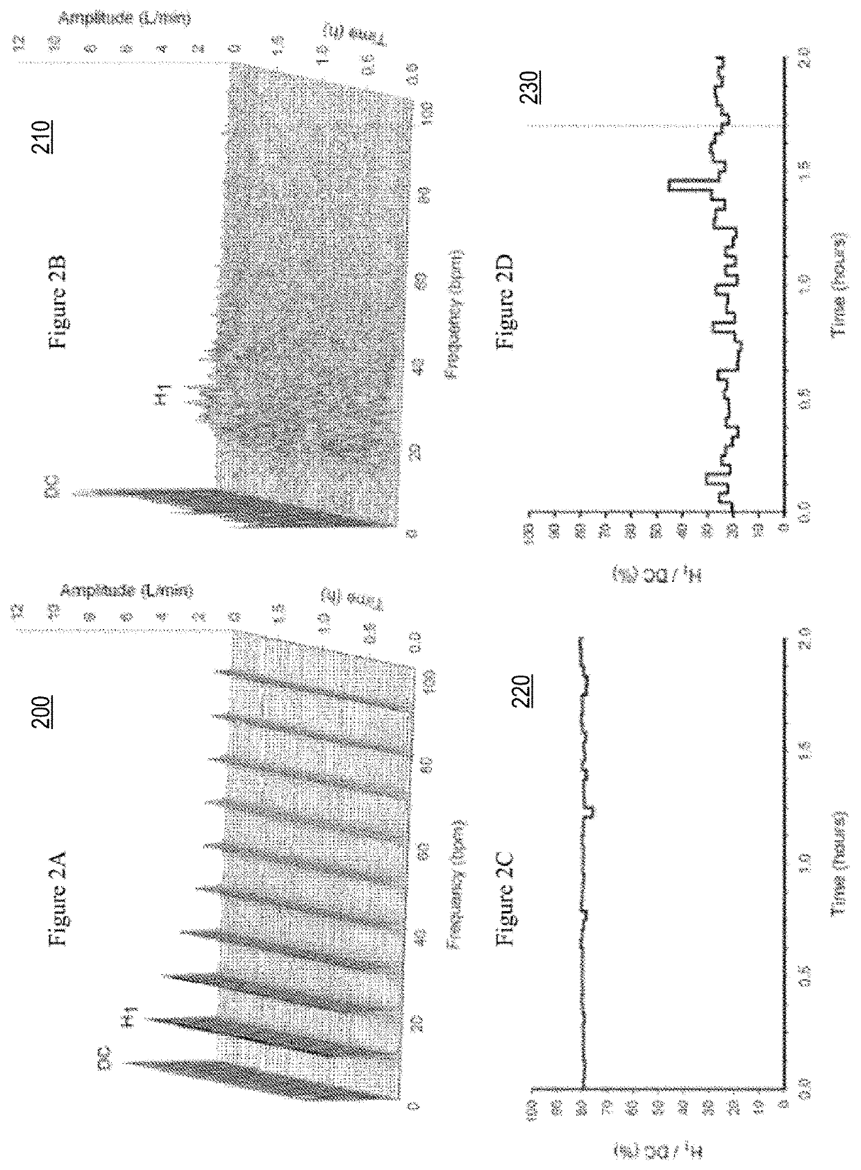 Detection and Display of Respiratory Rate Variability, Mechanical Ventilation Machine Learning, and Double Booking of Clinic Slots, System, Method, and Computer Program Product