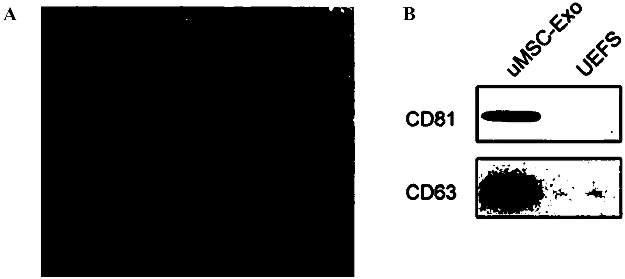 Application of stem cell exosomes in promoting vascularization and angiogenesis