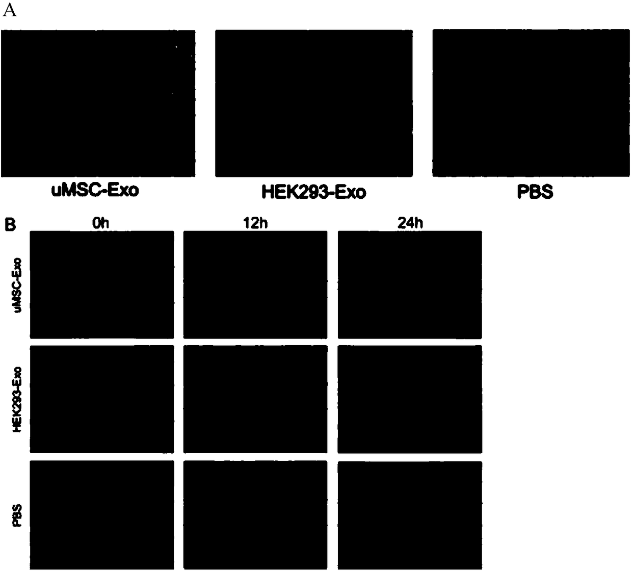 Application of stem cell exosomes in promoting vascularization and angiogenesis