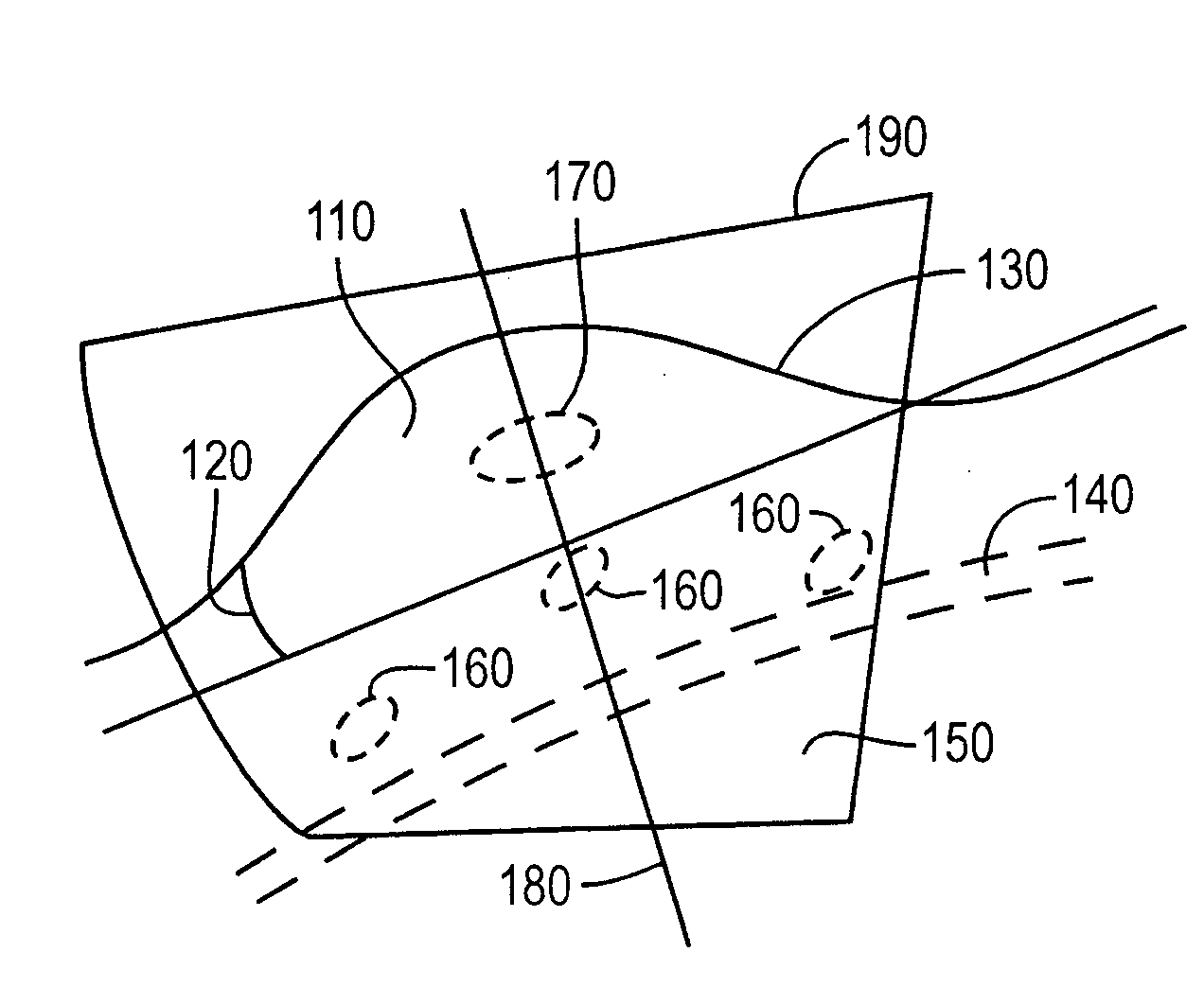 System and method for patient setup for radiotherapy treatment