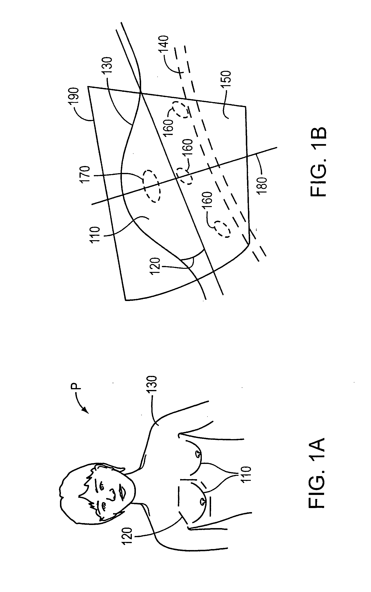 System and method for patient setup for radiotherapy treatment