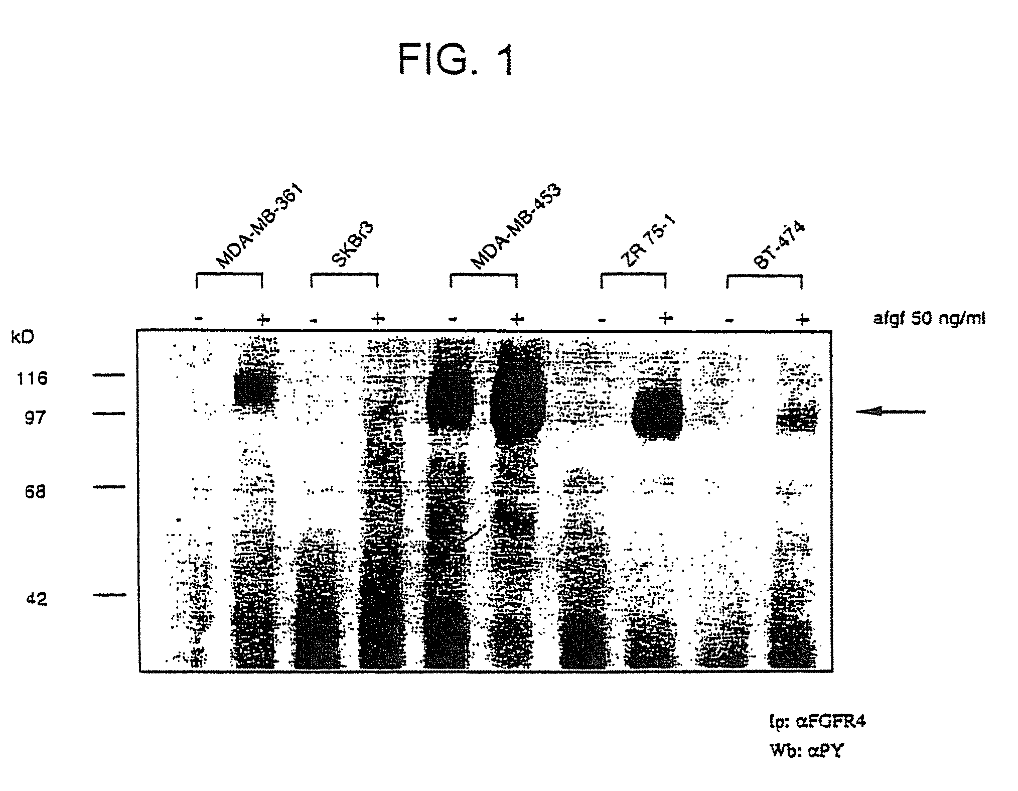 Method of diagnosing an RTK-hyperfunction-induced disorder