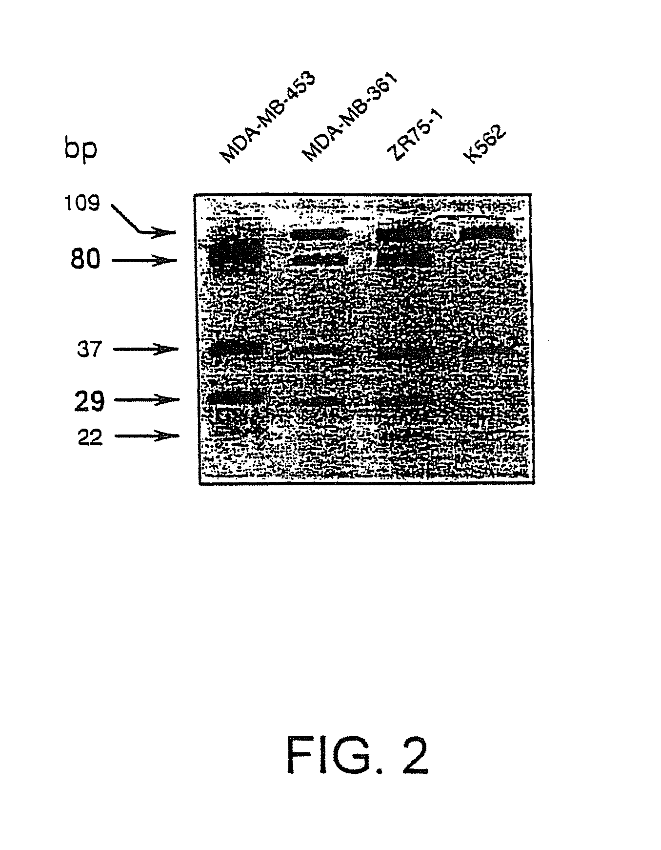 Method of diagnosing an RTK-hyperfunction-induced disorder