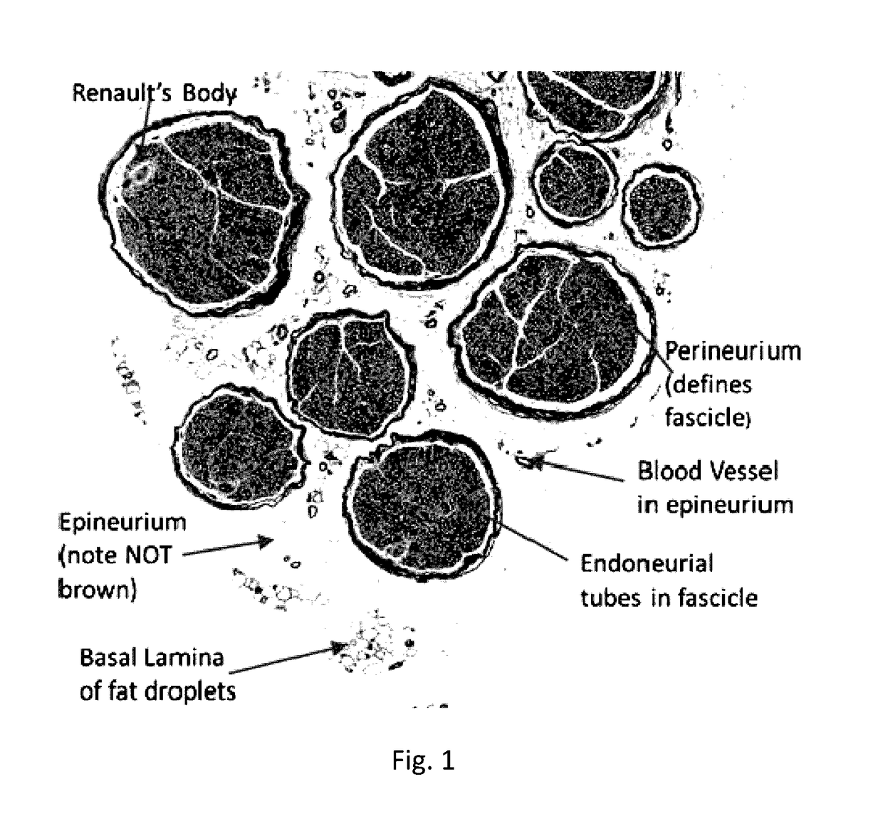 Quantitative structural assay of a nerve graft