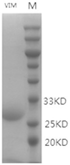 Anti-VIM carbapenemase hybridoma cell strain, monoclonal antibody and application