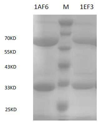 Anti-VIM carbapenemase hybridoma cell strain, monoclonal antibody and application