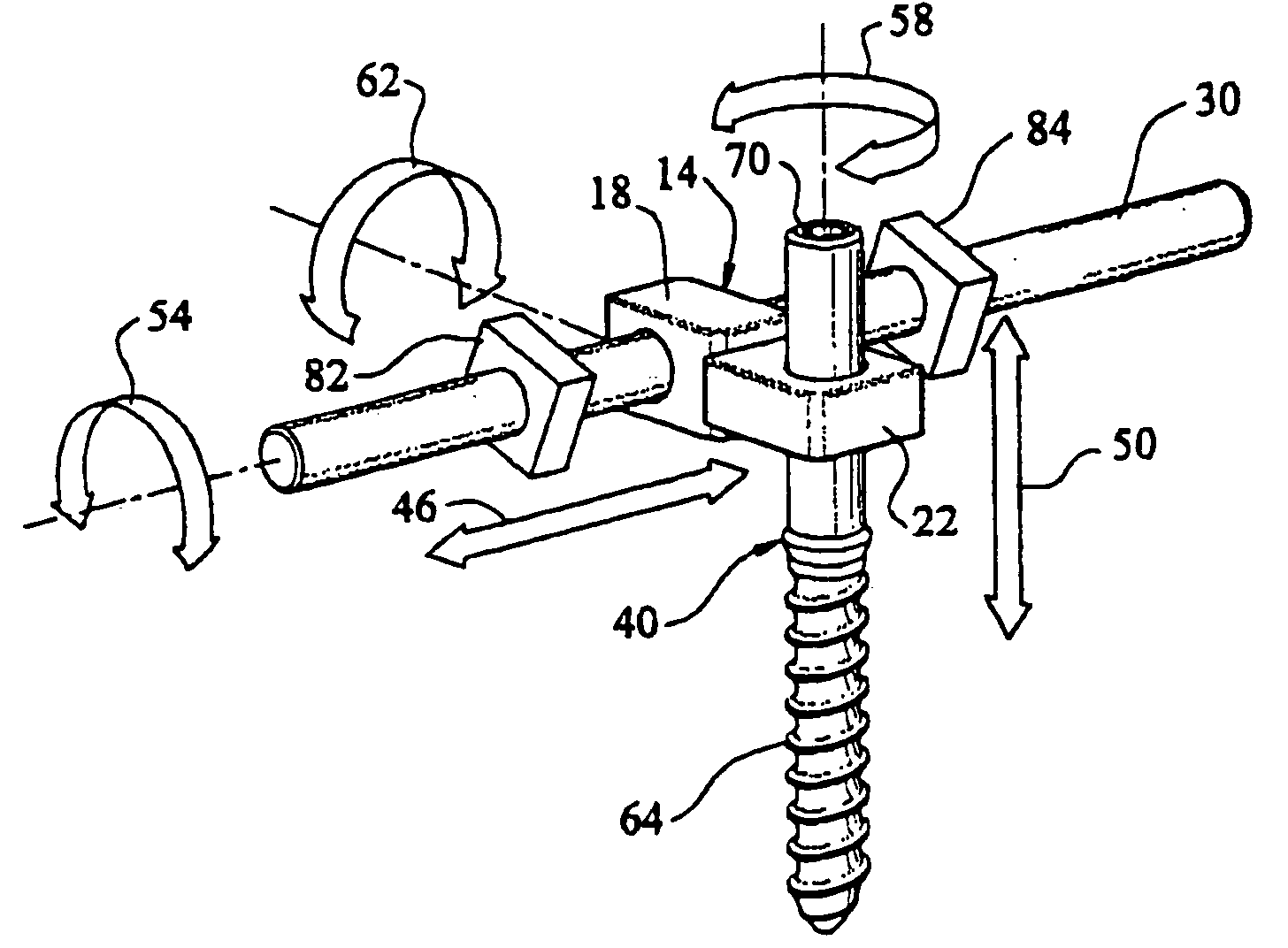 Artificial facet joint and method