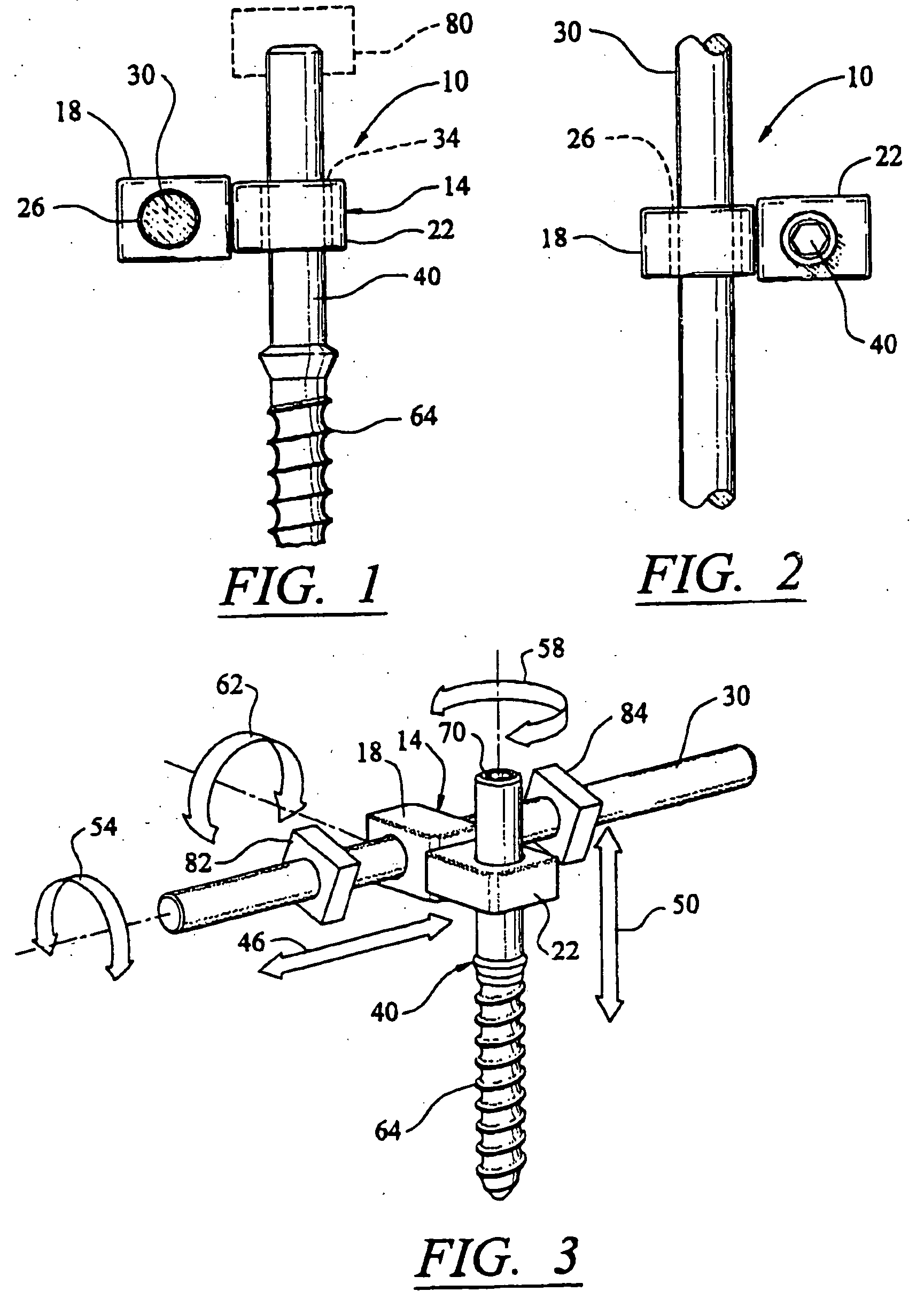 Artificial facet joint and method