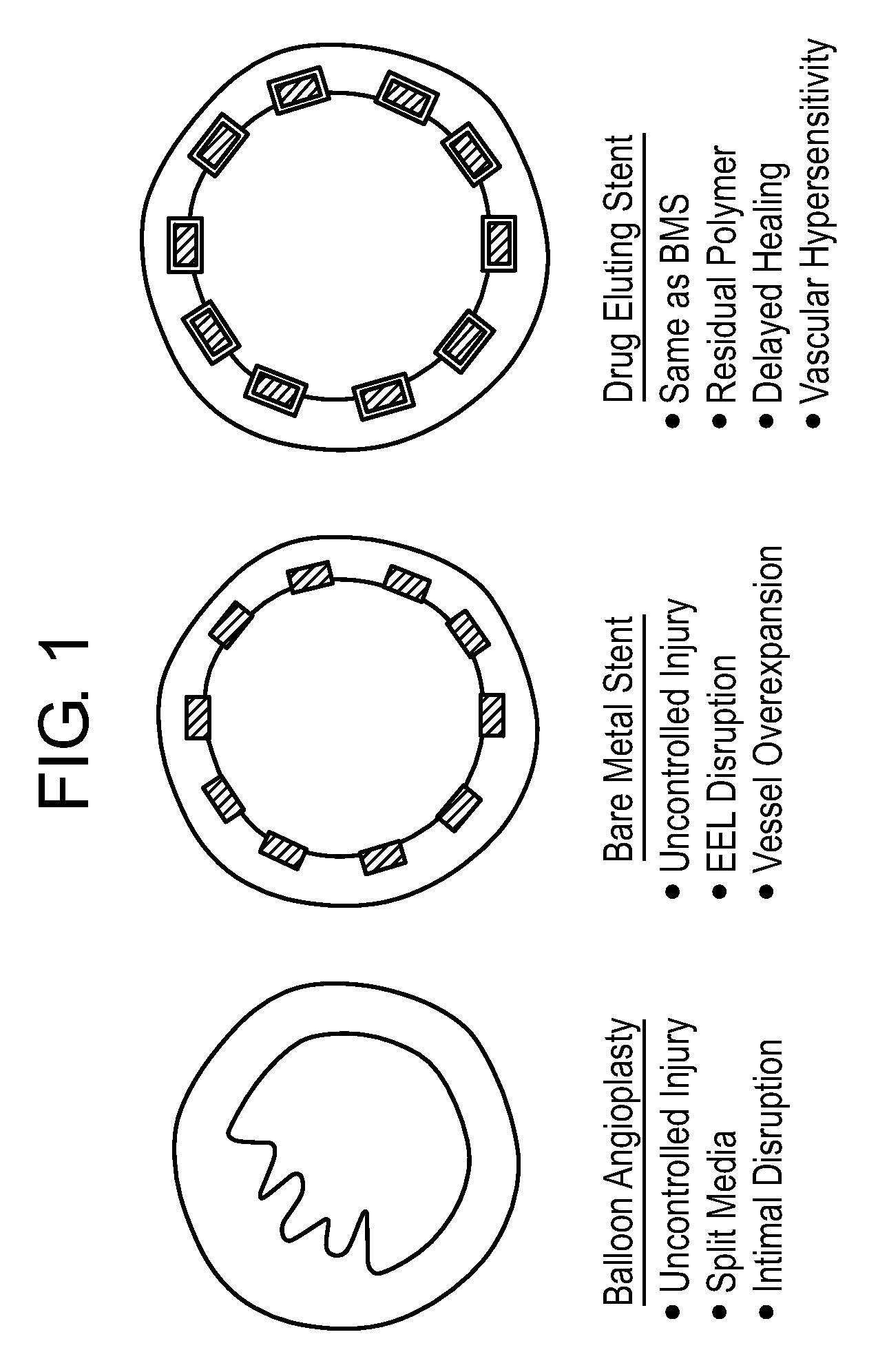 Composite Vascular Prosthesis