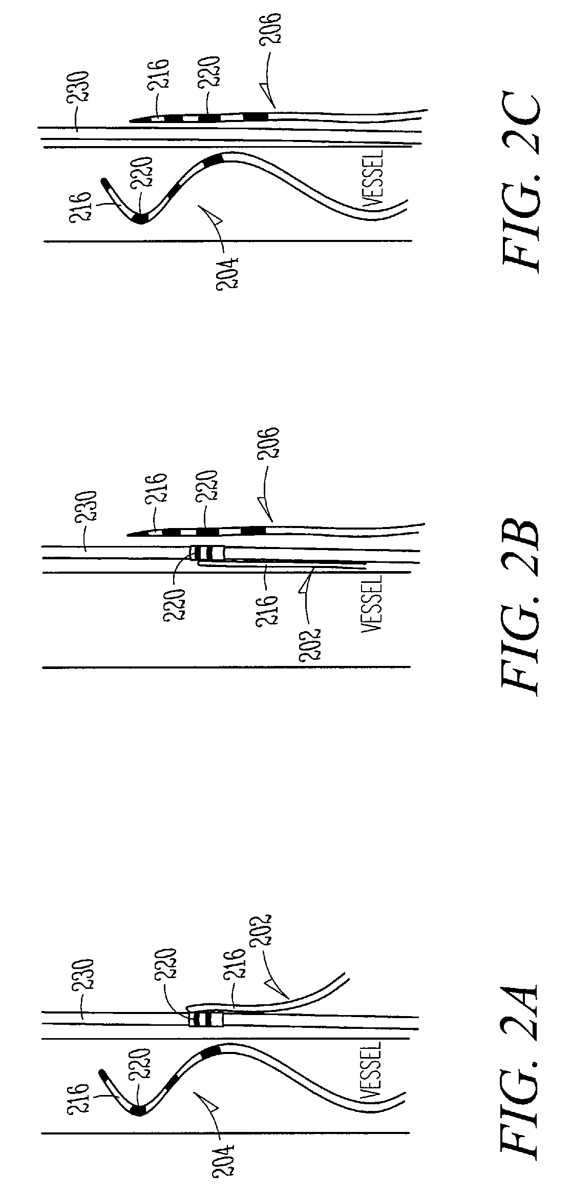 Selective nerve stimulation with optionally closed-loop capabilities