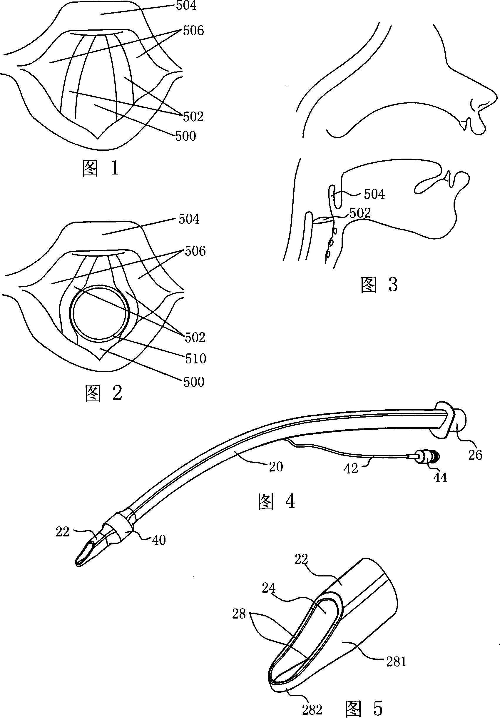 Gas barrel conduit pipe