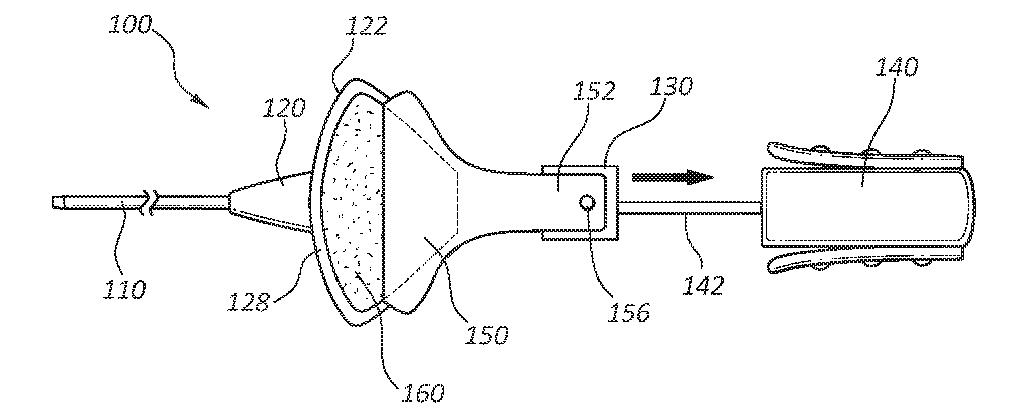 Adhesive backed iv catheter with auto release liner