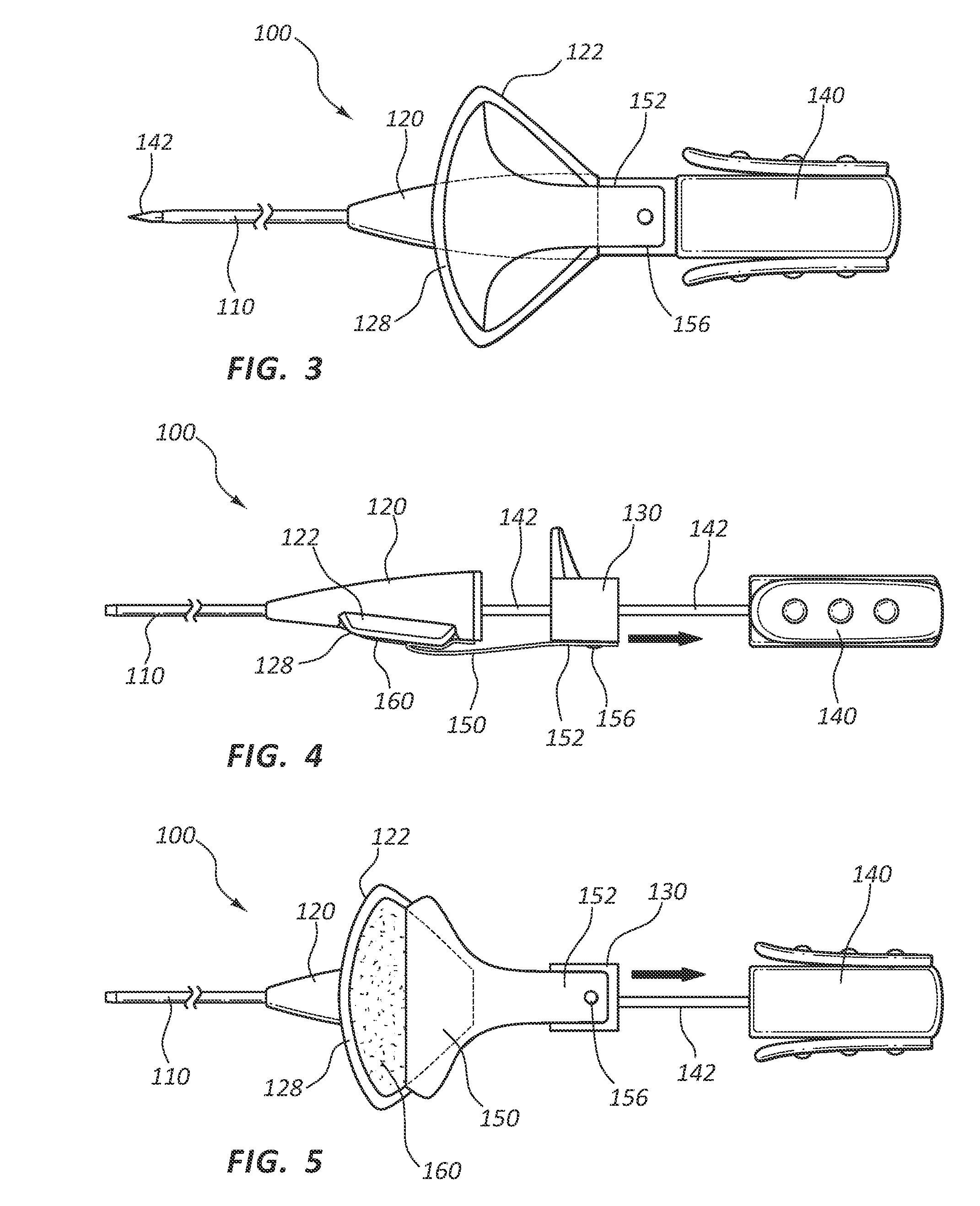 Adhesive backed iv catheter with auto release liner