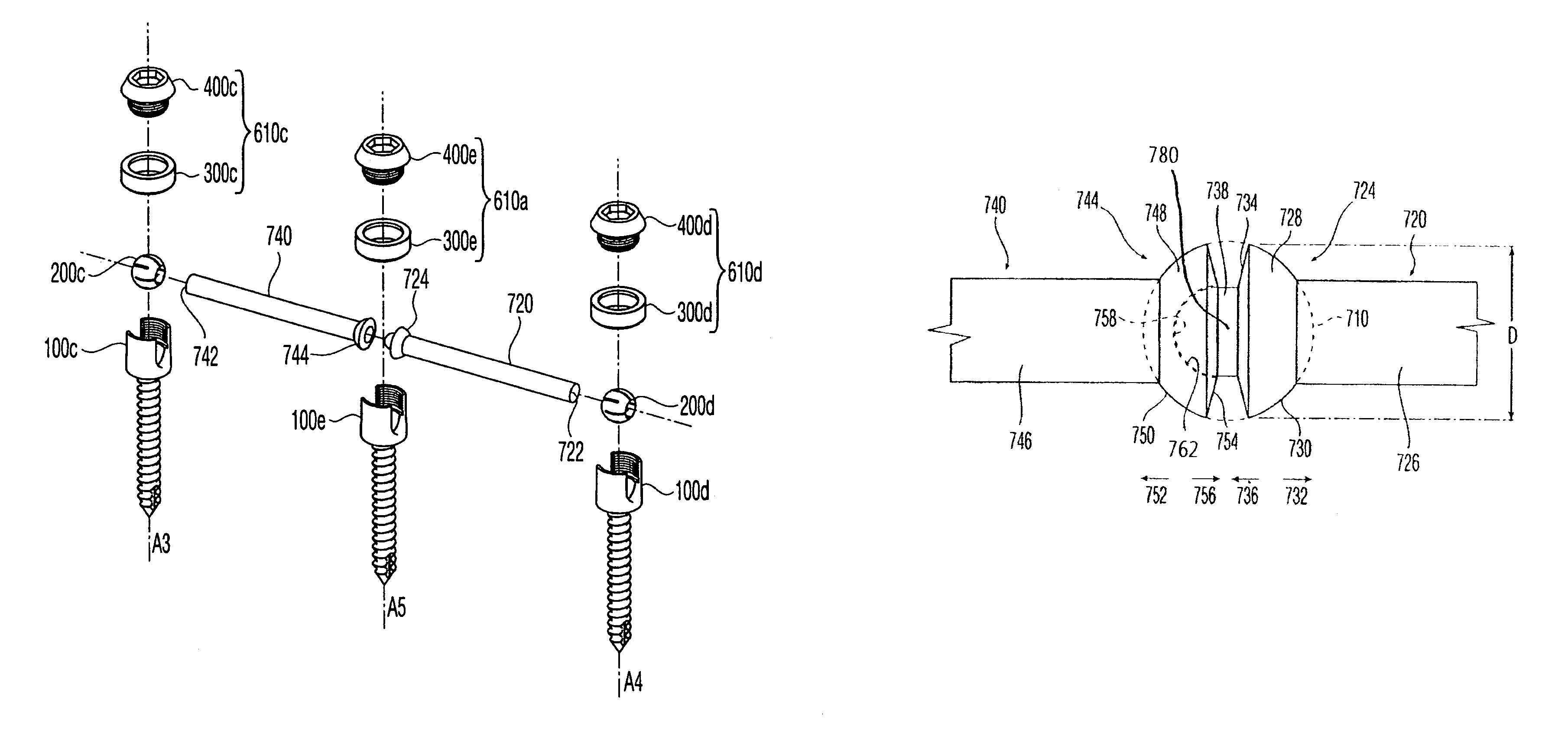 Ball jointed pedicle screw and rod system