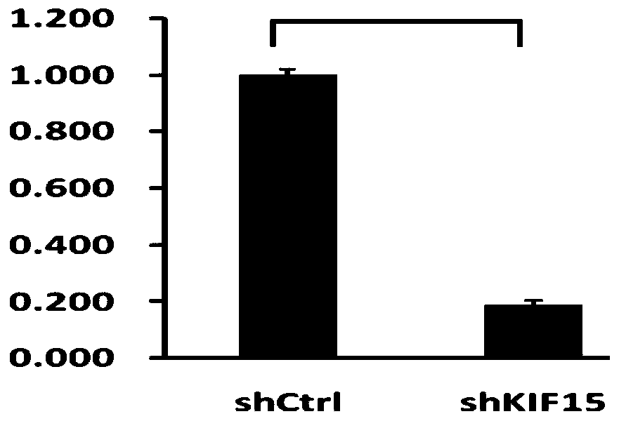 Use of kif15 inhibitors in the preparation of drugs for treating lung cancer