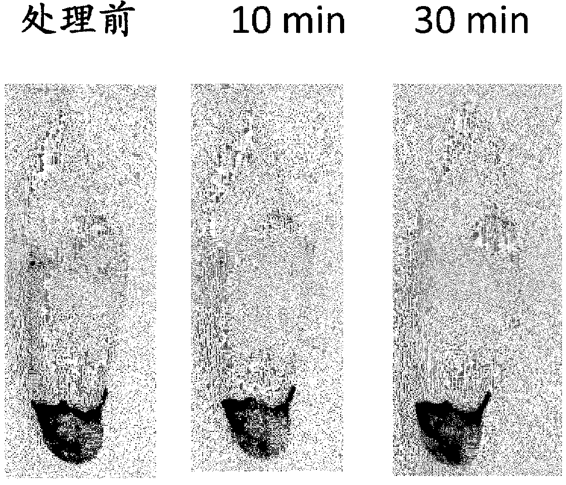 Oral composition for removing tooth stain