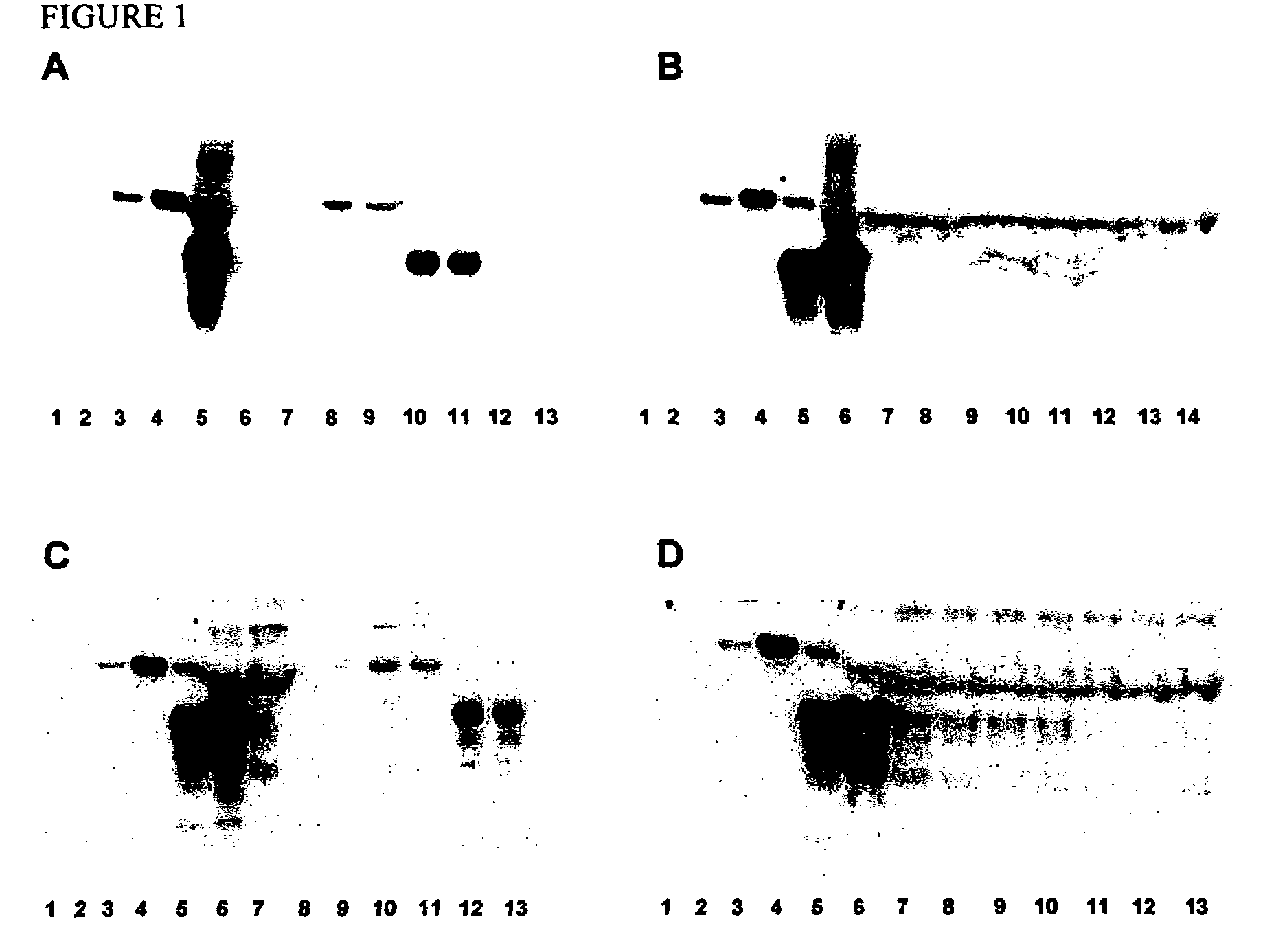 Prion protein binding materials and methods of use