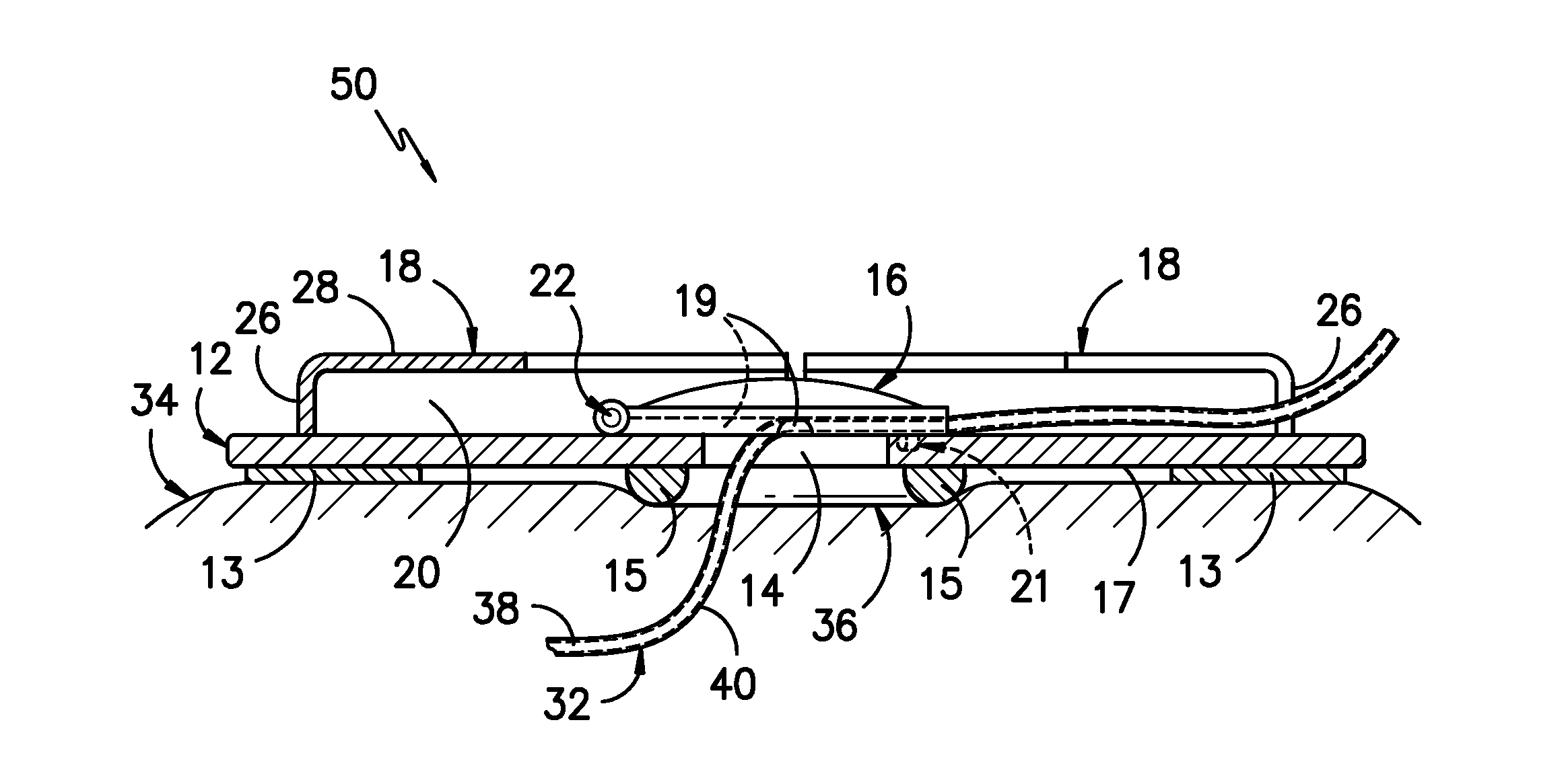 Catheter Securement Device