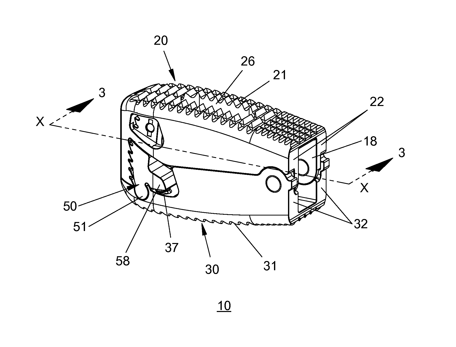 Adjustable Implant and Insertion Tool